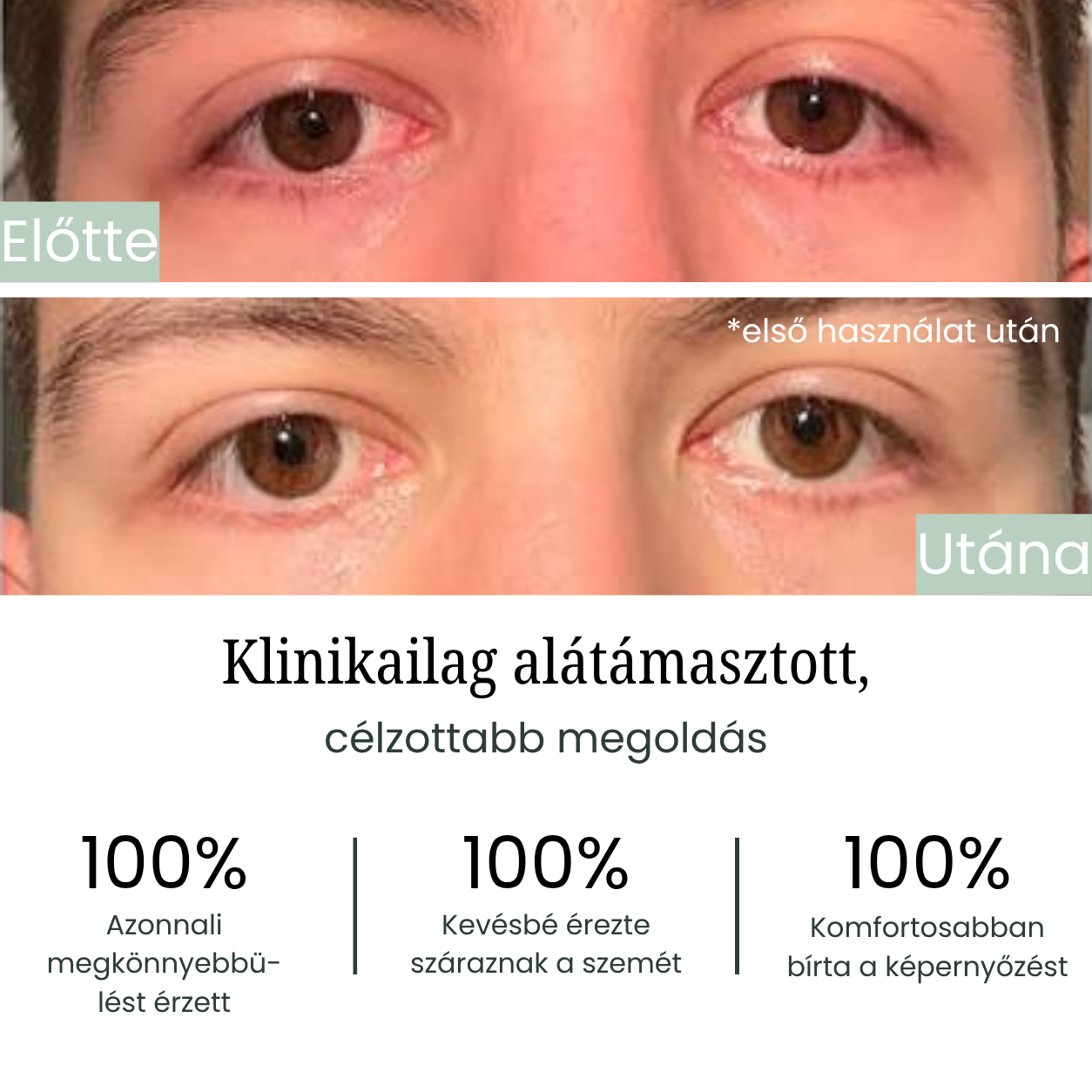 Szemszárazság Kezelő Készülék